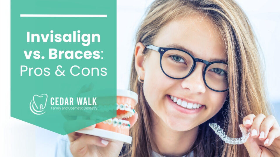 Invisalign vs Braces: Which You Should Consider?
