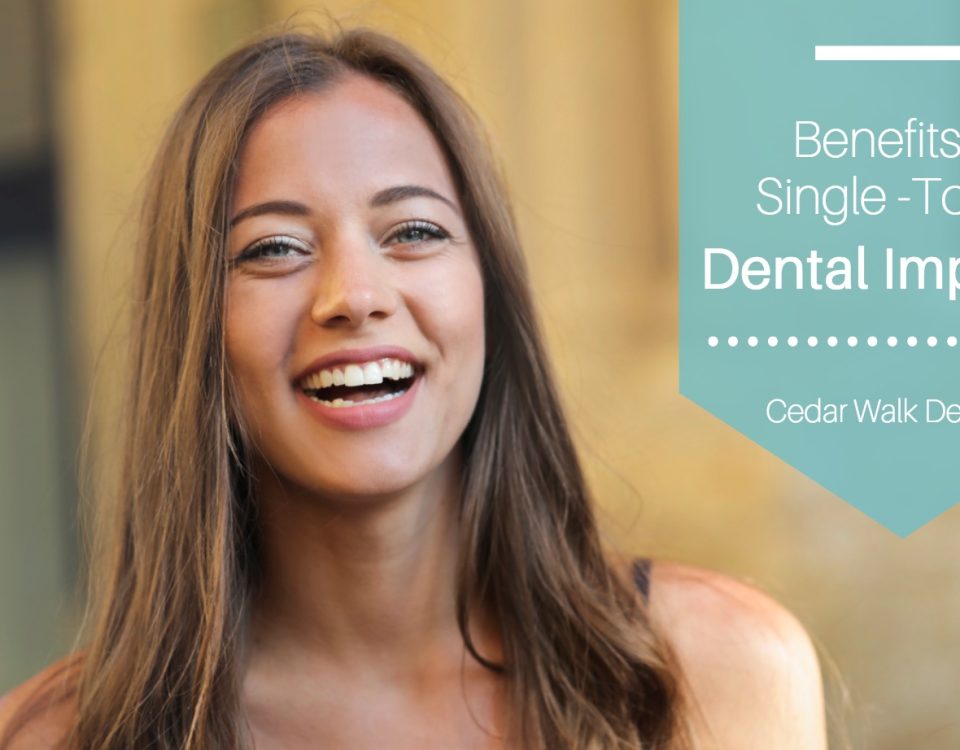 Benefits of Single-Tooth Dental Implants