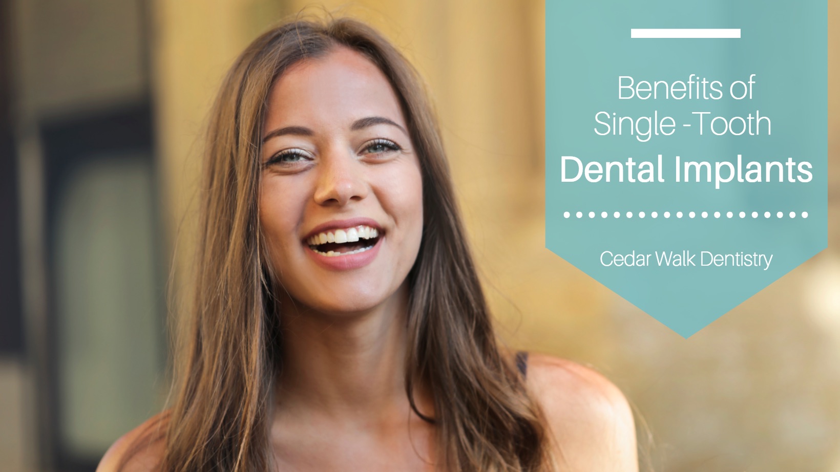 Benefits of Single-Tooth Dental Implants