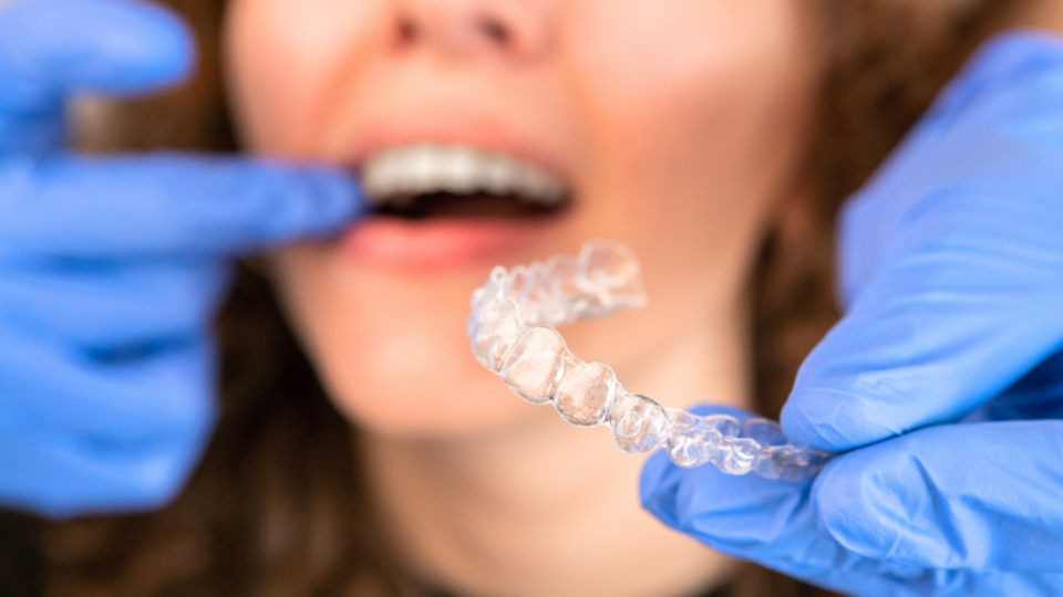 what are the benefits of invisalign