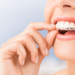 How to Clean Invisalign Retainers