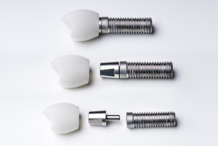 Dental Implants