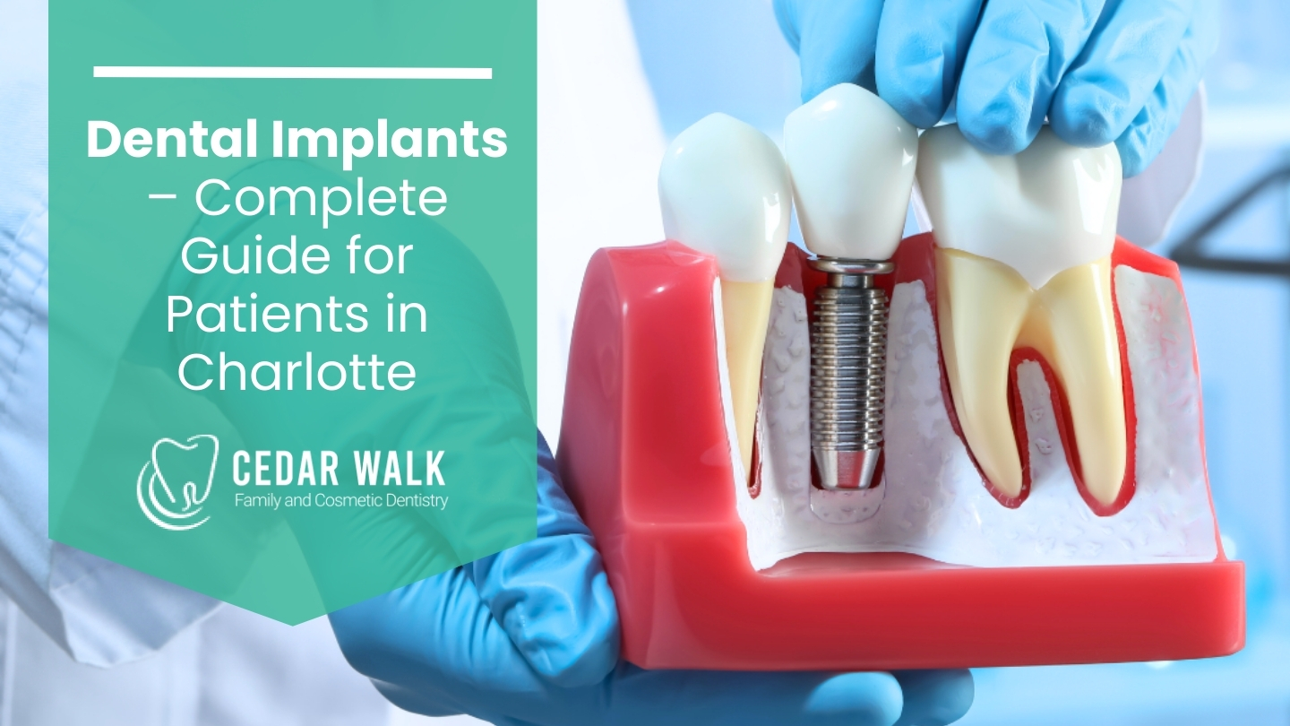 dental implants charlotte guide