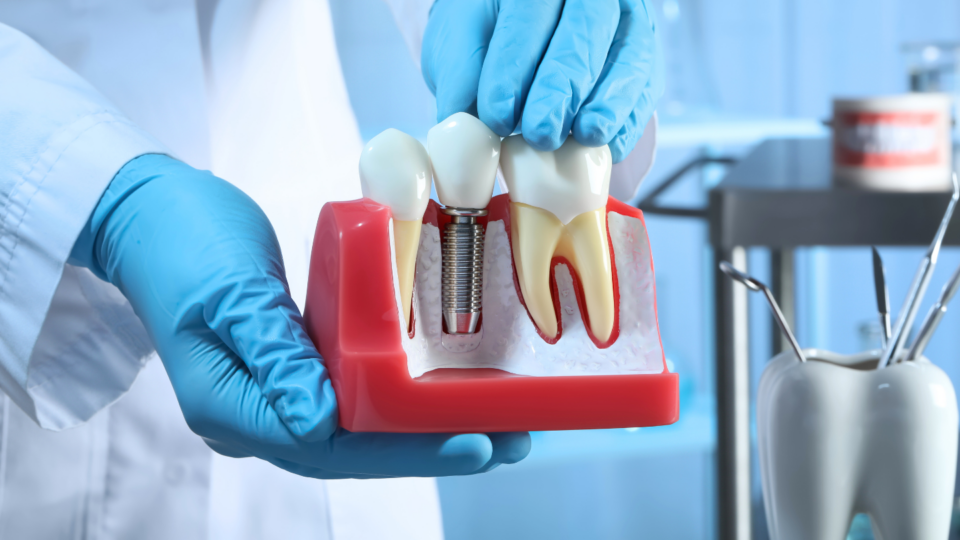 how do dental implants work