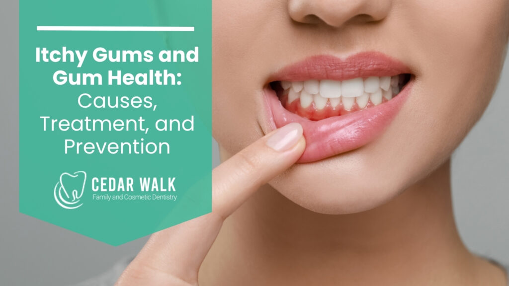 Itchy Gums