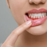 Itchy Gums and Gum Health