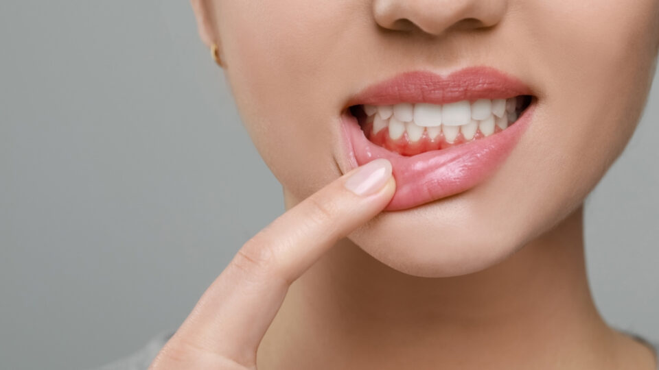Itchy Gums and Gum Health