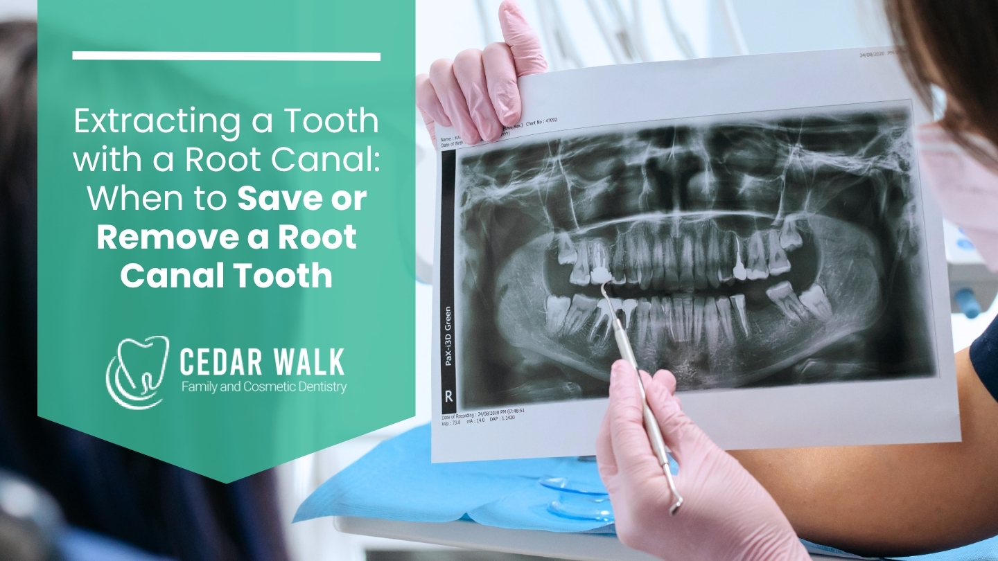 When to Save or Remove a Root Canal Tooth