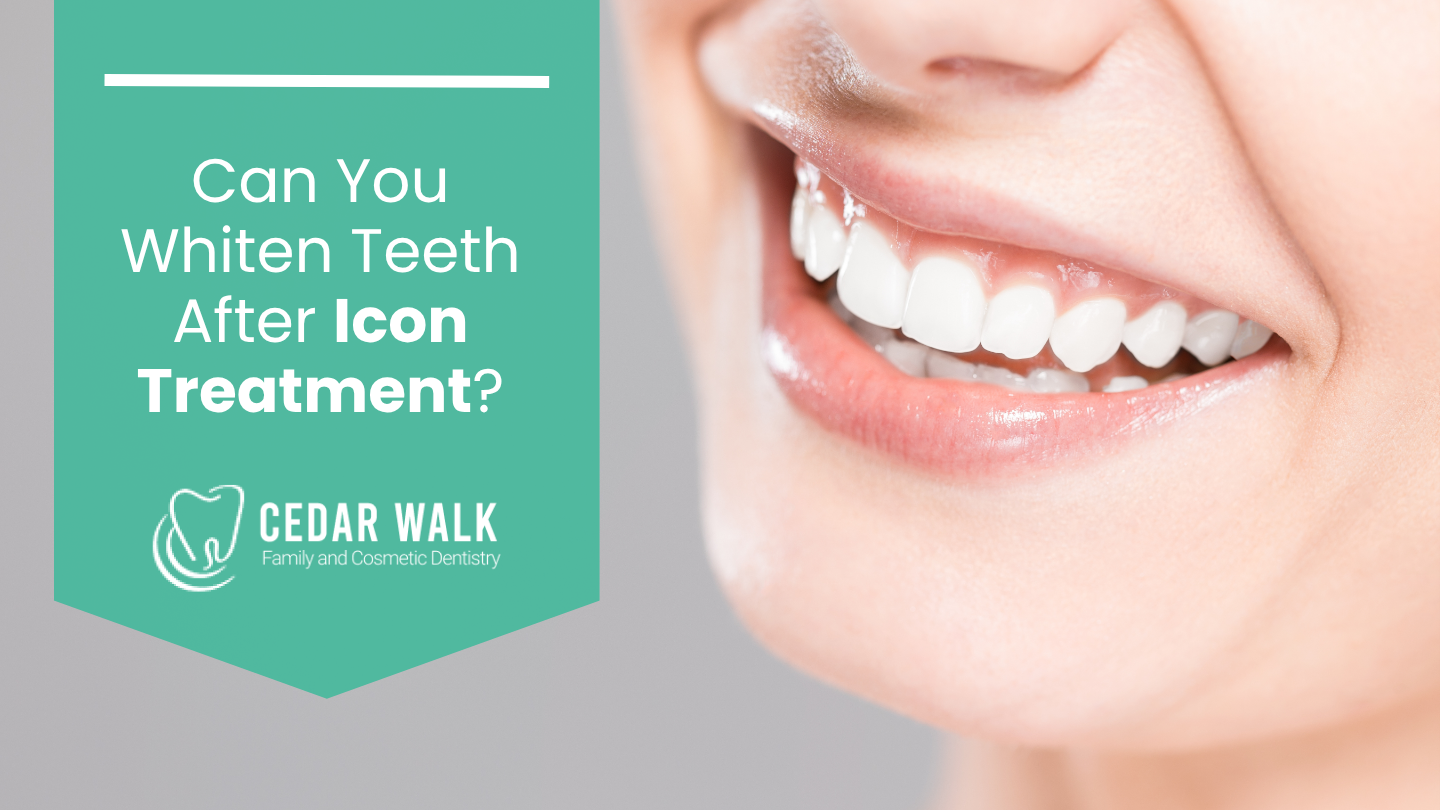 can you whiten teeth after icon treatment