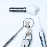 dental implants vs. bridges