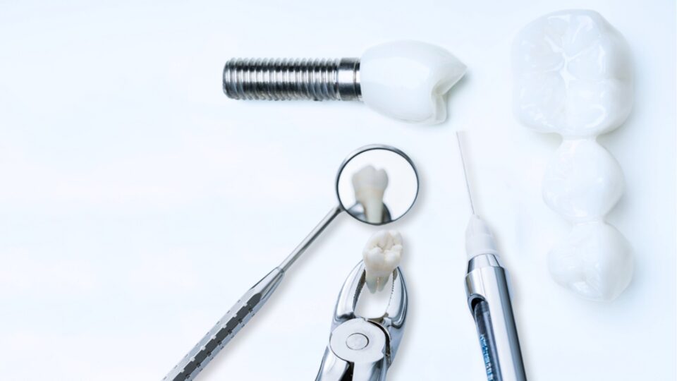 dental implants vs. bridges
