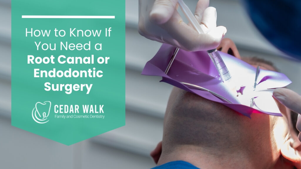 root canal vs endodontic surgery charlotte