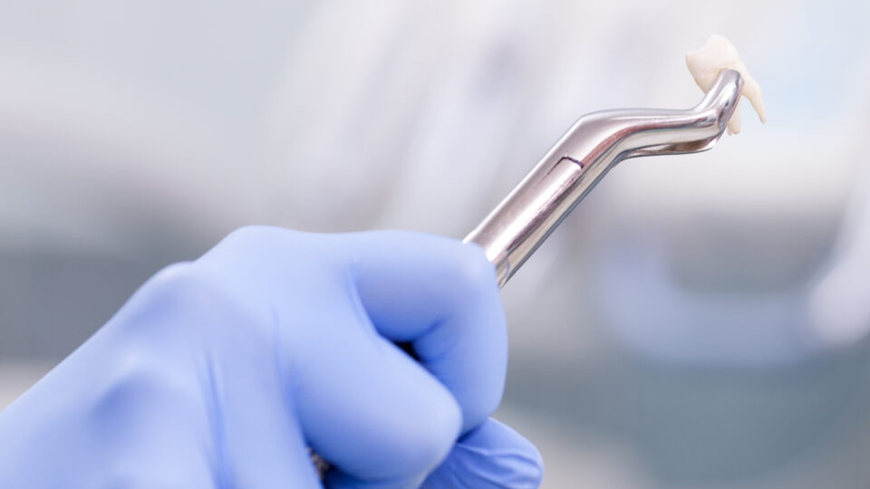 how does a dentist pull a tooth